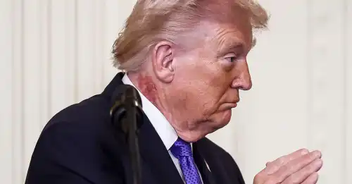 Як Трамп позбувся червоних плям на шиї: пояснення лікаря